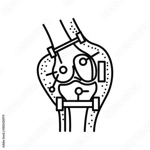 Human knee joint diagram with medical implant or brace outline