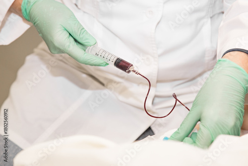 Close up of nurse or lab technician drawing blood samples using a catheter and tube holder in the hospital clinic