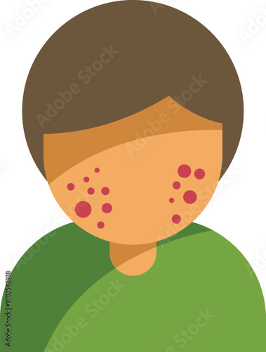 Young man is suffering from a skin rash caused by chickenpox