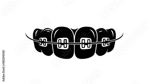 Vector illustration of closeup black silhouette of dental braces on teeth isolated on transparent background 