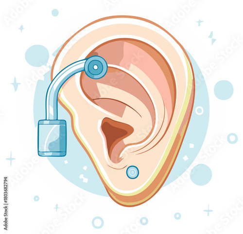 Human ear with behind the ear hearing aid for improved hearing medical device illustration