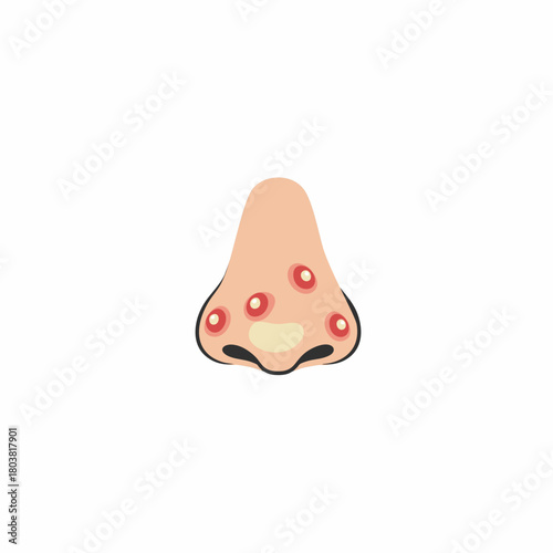 vector illustration of blackhead acne on nose isolated on white background
