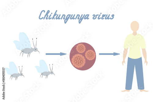 Chikungunya virus infection diagram. Italicized text. Mosquito-virus-man in clothes. Color vector illustration. Isolated on white background. Flat style. Medical theme. Web design idea.