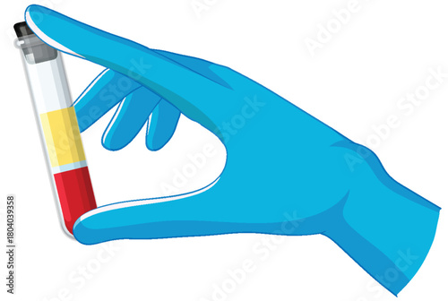 Gloved Hand Holding Blood Sample Test Tube