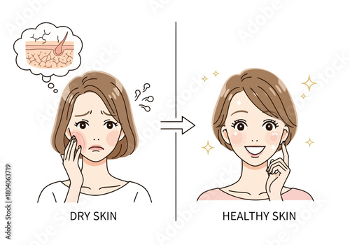 Illustration of illustration showing a woman with dry skin looking concerned, contrasted with a happy woman with healthy, glowing skin