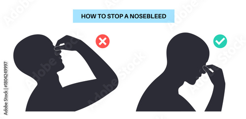 Stop nosebleed instruction