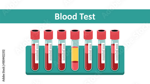 Blood Test Tubes in Laboratory Rack – Medical Analysis and Hematology Illustration
