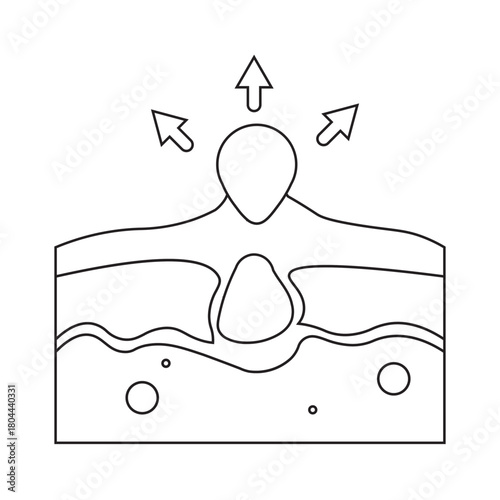 Pimple Removal Illustration