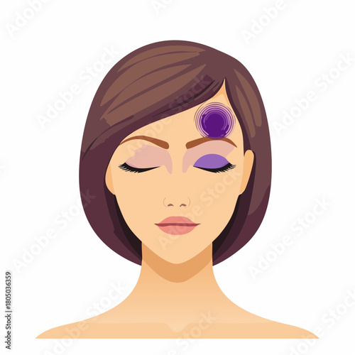 A small, bruised contusion on the temple area, exhibiting purplish discoloration beneath unbroken skin.