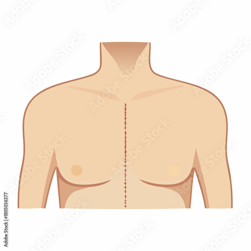 An older, fading scar on the chest, appearing as a pale, smooth, raised line contrasting with surrounding skin.