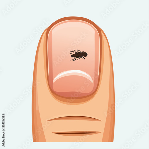 A close-up view of a recently removed splinter, leaving a small, clean entry hole in the fingertip.