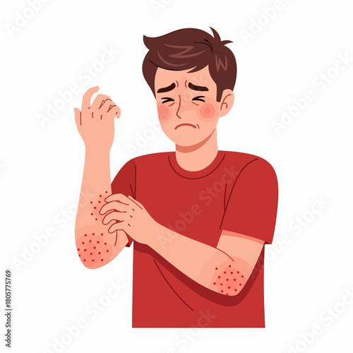 Young Man Suffering from Skin Allergy, Itching and Scratching Red Rash on Arm - Hives, Eczema, or Dermatitis Symptom Illustration