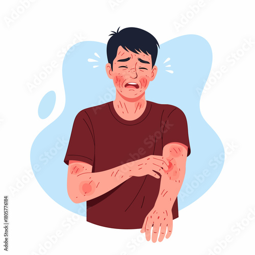 Distressed Man with Severe Skin Rash, Allergy, or Eczema Illustration