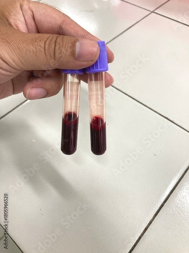 hand holding two blood sample tubes
