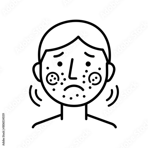 Sad face with acne and skin irritation on for dermatology and skincare in black and white style isolated on