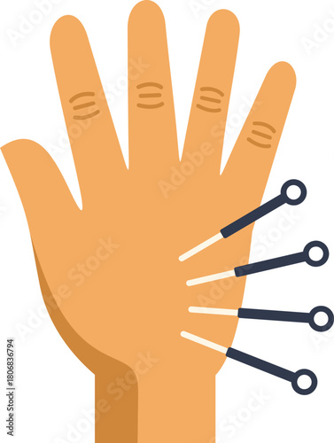 Acupuncturist is applying acupuncture needles to a hand for pain relief