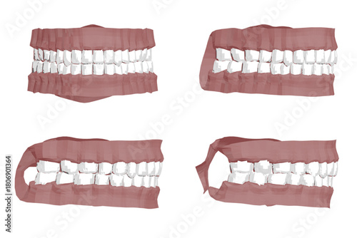 Polygonal human teeth set with four different types, each missing one tooth. Animated 3D render creates a dynamic motion effect.