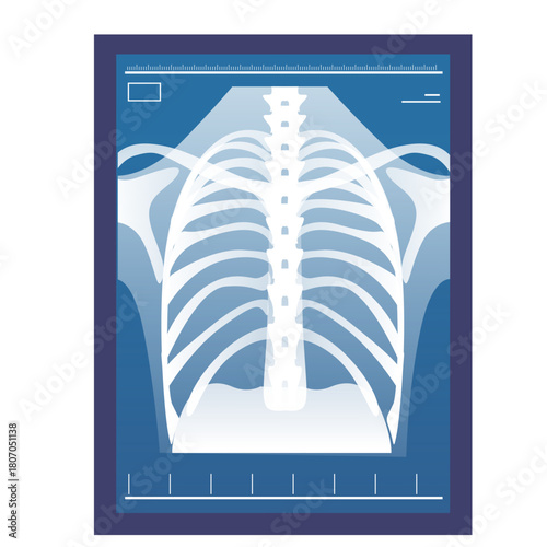 Human Chest X-ray Illustration Medical Diagnostic Health Care