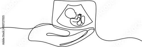 continuous line hand holding ultrasound photo of baby. scan photo of baby in womb. one line Icon drawing with white background