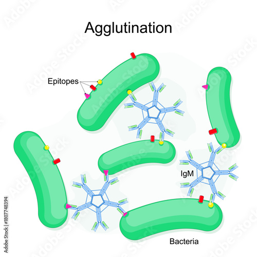 Bacterial agglutination. Medical test for pathogen detection. Bacteria Cells clumping. IgM Antibody antigen interaction. Epitopes