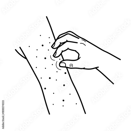 Line drawing illustration of a hand scratching an arm covered in small dots representing an itchy rash or skin irritation, isolated on