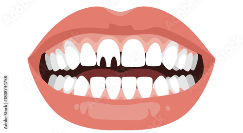 Illustration of a wide open mouth revealing white teeth, with one incisor tooth having a unique shape.