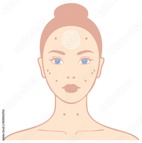 Woman's Face with Skin Problems or Ailments with Third Eye Chakra Illustration