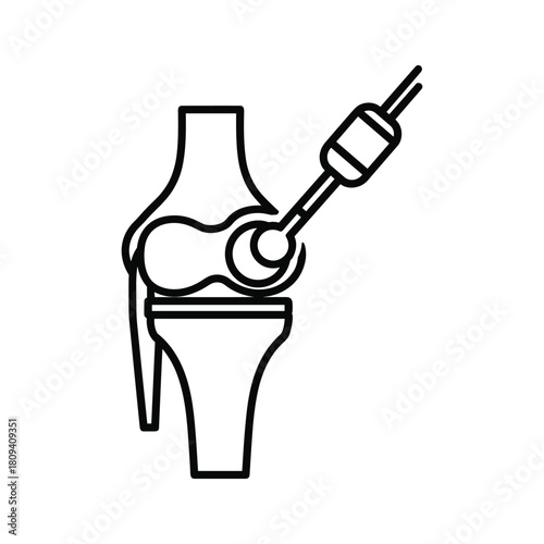Knee joint injection procedure for pain relief and orthopedic treatment, medical illustration