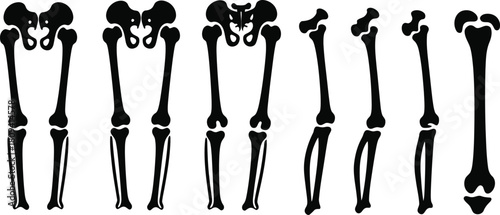 Set Of Human Leg Bones Alignment Vector Illustration