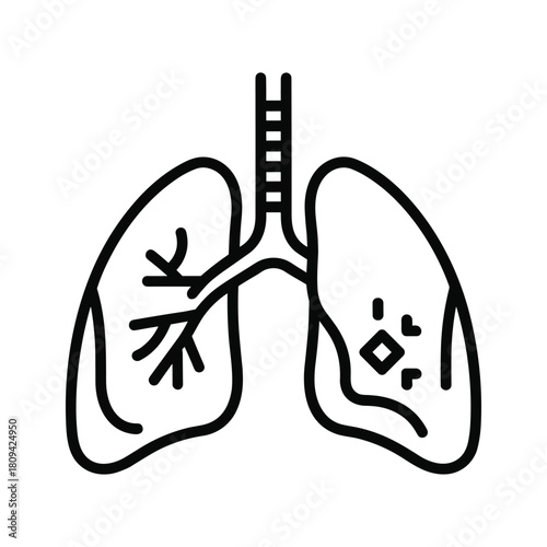 Illustration of lungs with a tumor, depicting lung cancer, isolated on