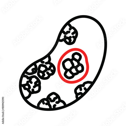 Illustration of a kidney bean with tumors, isolated on