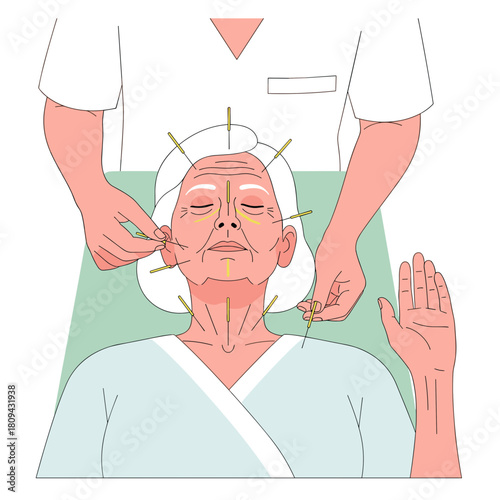 Elderly woman receiving acupuncture treatment in wellness clinic  
