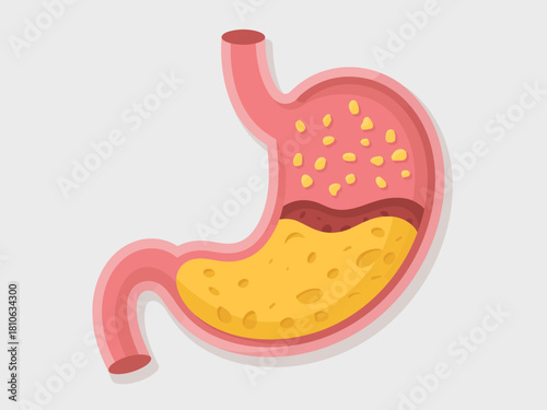 A colorful cartoon illustration of a human stomach, depicting anatomical features in a simplified way, useful for educational and health-related content.