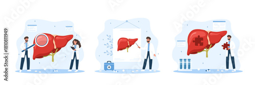 Hepatitis and liver disease set. Medical research and therapy with doctor and patient. Flat cartoon illustration.