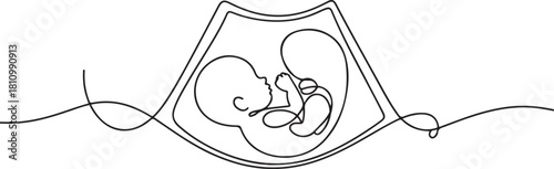 Continuous line design of baby ultrasound results. one line Icon drawing with white background