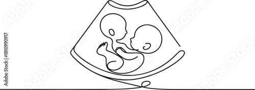 Continuous line design of baby ultrasound results. one line Icon drawing with white background