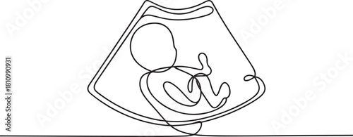 Continuous line design of baby ultrasound results. one line Icon drawing with white background