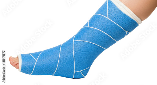 Person's leg in a bright blue orthopedic cast. cutout on transparent background