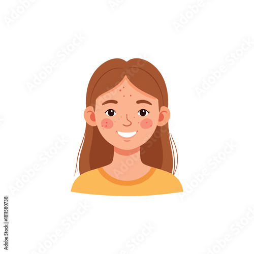 Illustration portraying a girl with acne showcasing youthful skin and promoting body positivity in