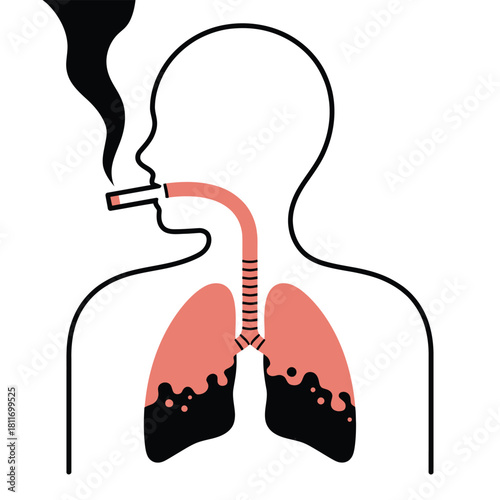 Damaged lungs illustration from cigarette smoke inhalation