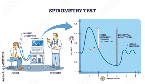 Spirometry test brief diagram showing patient with mouthpiece, spirometer monitor, and FEV1-FVC curve explaining lung function assessment. Outline diagram