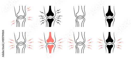 Knee pain and inflammation illustration set showcasing various conditions like arthritis, injury, and joint discomfort, human bone health