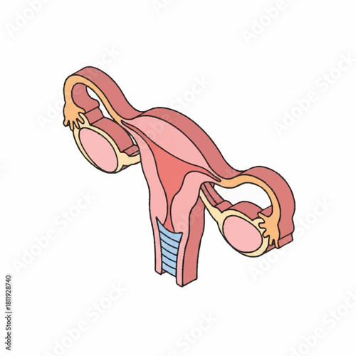 Anatomical illustration of the female reproductive system including uterus ovaries and fallopian tubes.