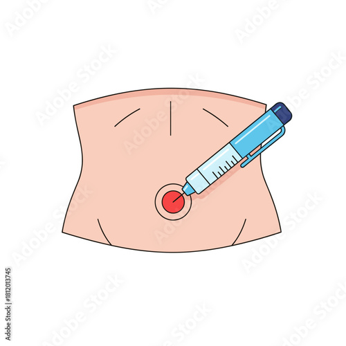 Insulin injection with syringe on abdomen for diabetes management  