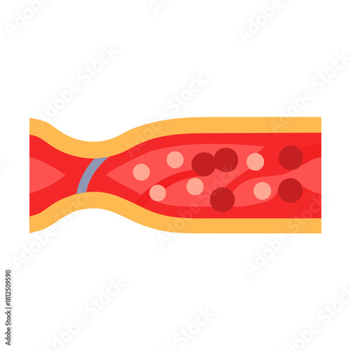 Simplified medical illustration of a blood vessel with blood cells flowing inside