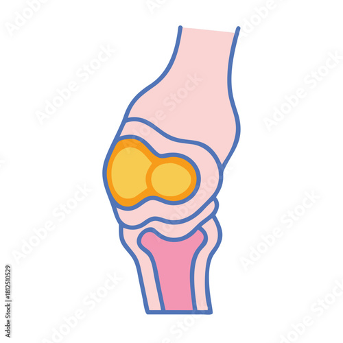 Stylized knee joint illustration with pastel colors and blue outline on black background