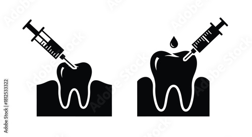 Dental anesthesia illustration showing syringes injecting into teeth with gum lines