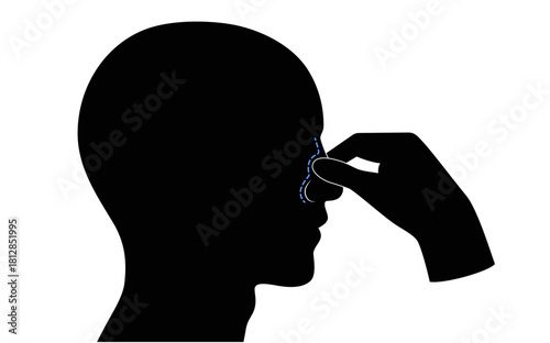 Stop nosebleed instruction