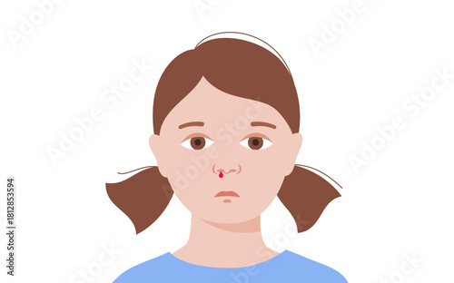 Nosebleed medical poster