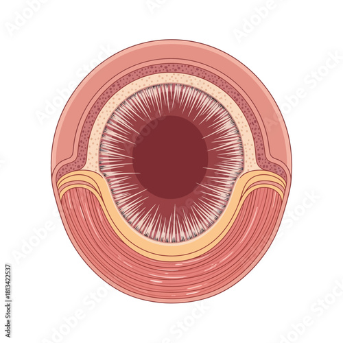 Cross-section of a healthy digestive tract with villi, muscle layers, and outer tissue